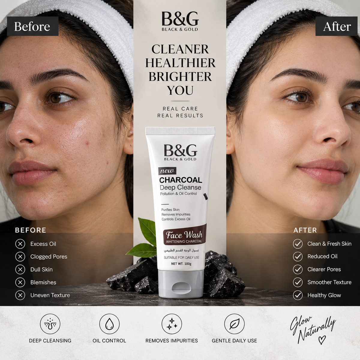 B&G Black & Gold Charcoal Deep Cleanse Face Wash before and after skincare comparison
