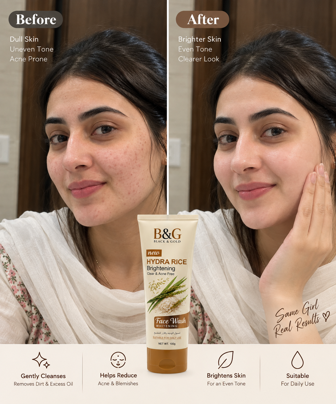 B&G Black & Gold Hydra Rice Brightening Face Wash before and after skincare comparison